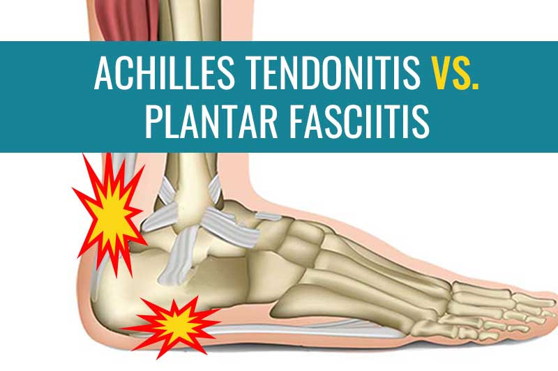 what is the difference between Achilles tendonitis and plantar fasciitis?