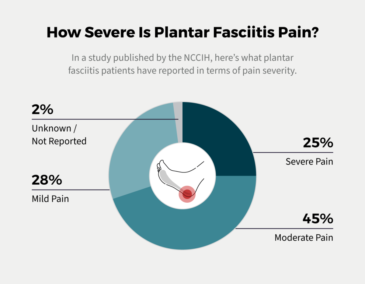 how-severe-is-plantar-fasciitis-pain how severe is plantar fasciitis pain?