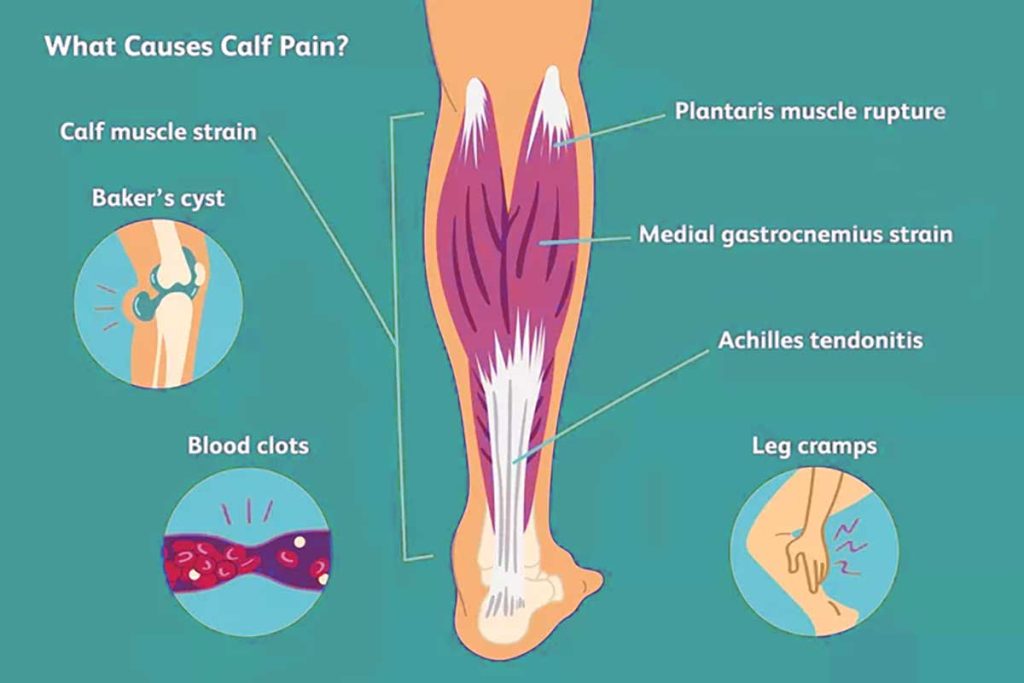 what causes calf pain and calf cramps